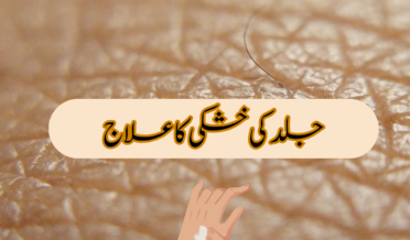 جلد کی خشکی کا علاج