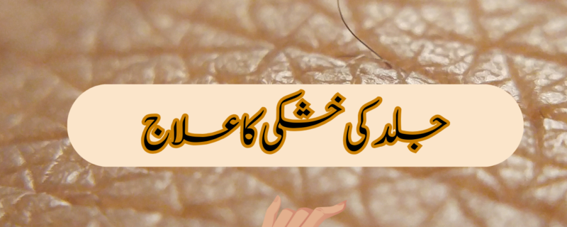 جلد کی خشکی کا علاج